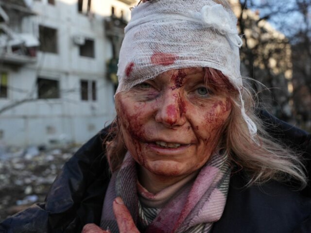 mujer-herida-guerra-ucrania-rusia-1