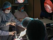 Realiza IMSS Bienestar primera corrección intrauterina de gastrosquisis fetal en México